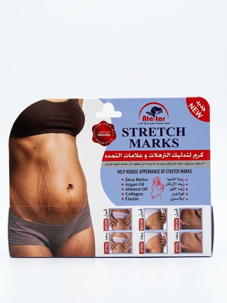 Stretch Marks Cream
